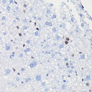 Immunohistochemistry analysis of paraffin-embedded mouse liver using Anti-Cyclin D1 Antibody [ARC0300] (A306339) at a dilution of 1:100 (40X lens). Perform high pressure antigen retrieval with 10 mM citrate buffer pH 6.0 before commencing with IHC staining protocol