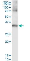 Anti-STK16 Polyclonal Antibody Pair