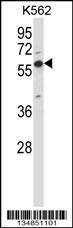 Anti-OXSR1 Rabbit Polyclonal Antibody (AP (Alkaline Phosphatase))