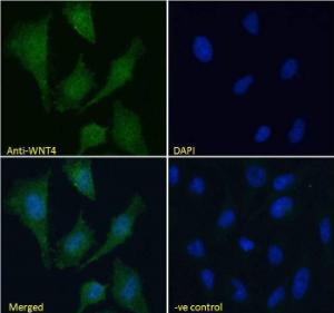 Anti-WNT4 Antibody (A83822) Immunofluorescence analysis of paraformaldehyde fixed HeLa cells, permeabilized with 0.15% Triton. Primary incubation 1hr (10µg/ml) followed by Alexa Fluor 488 secondary antibody (4µg/ml), showing vesicle staining.