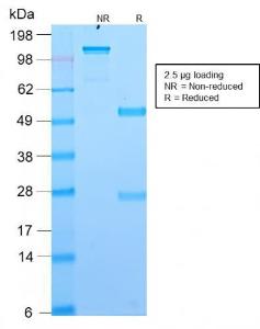 SDS-PAGE analysis of Anti-TMEM16A Antibody [DG1/2564R] under non-reduced and reduced conditions; showing intact IgG and intact heavy and light chains, respectively. SDS-PAGE analysis confirms the integrity and purity of the antibody