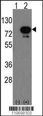 Anti-DEAF1 Rabbit Polyclonal Antibody (HRP (Horseradish Peroxidase))