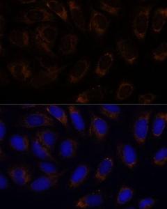 Anti-RAMP1 Rabbit Polyclonal Antibody