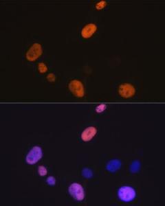 Immunofluorescence analysis of C6 cells using Anti-Cyclin D1 Antibody [ARC0300] (A306339) at a dilution of 1:100 (40X lens). DAPI was used to stain the cell nuclei (blue)