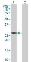 Anti-APOA1 Rabbit Polyclonal Antibody