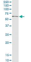 Anti-GLCE Polyclonal Antibody Pair