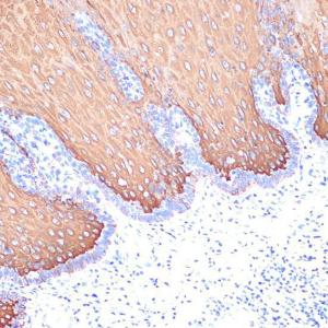 Immunohistochemistry analysis of paraffin-embedded human esophageal using Anti-Cytokeratin 6c Antibody [ARC2352] (A309251) at a dilution of 1:100 (40x lens) Perform microwave antigen retrieval with 10 mM Tris/EDTA buffer pH 90 before commencing with IHC staining protocol