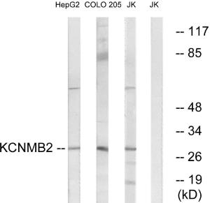 Western blot analysis of lysates from Jurkat, COLO, and HepG2 cells using Anti-KCNMB2 Antibody. The right hand lane represents a negative control, where the antibody is blocked by the immunising peptide.