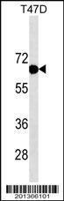 Anti-ESR1 Mouse Monoclonal Antibody [clone: 415CT16.3.2.1]