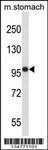 Anti-FER Rabbit Polyclonal Antibody