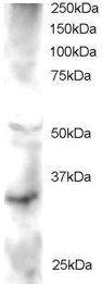 Anti-FRAT2 Antibody (A83823) staining (2 µg/ml) of Human Heart lysate (RIPA buffer, 30µg total protein per lane). Primary incubated for 1 hour. Detected by western blot using chemilu minescence