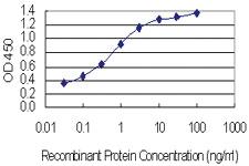 Anti-ASH1L Mouse Monoclonal Antibody [clone: 4G12]