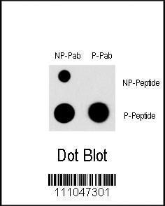 Anti-MEF2C Rabbit Polyclonal Antibody (Biotin)