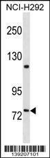 Anti-FERMT2 Rabbit Polyclonal Antibody (AP (Alkaline Phosphatase))