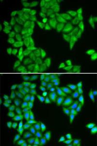 Immunofluorescence analysis of HeLa cells using Anti-SPAG5 Antibody (A6451). Blue: DAPI for nuclear staining