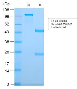 Anti-TMEM16A antibody