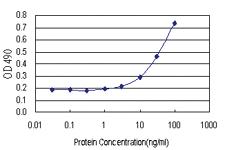 Anti-PRRX2 Polyclonal Antibody Pair