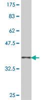 Anti-WAS Mouse Polyclonal Antibody