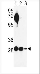 Anti-ECI1 Rabbit Polyclonal Antibody (AP (Alkaline Phosphatase))