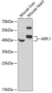 Western blot analysis of extracts of various cell lines, using Anti-AIPL1 Antibody (A9876) at 1:1000 dilution