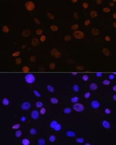 Immunofluorescence analysis of NIH-3T3 cells using Anti-Cyclin D1 Antibody [ARC0300] (A306339) at a dilution of 1:100 (40X lens). DAPI was used to stain the cell nuclei (blue)