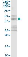 Anti-STK19 Antibody Pair