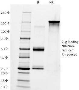 SDS-PAGE analysis of Anti-Human IgM Heavy Chain Antibody [IM260] under non-reduced and reduced conditions; showing intact IgG and intact heavy and light chains, respectively. SDS-PAGE analysis confirms the integrity and purity of the antibody.