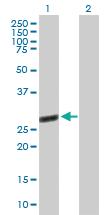 Anti-TTC9B Mouse Polyclonal Antibody