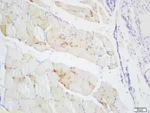 Anti-S100 A4 Rabbit Polyclonal Antibody