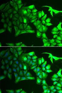 Immunofluorescence analysis of HeLa cells using Anti-AIPL1 Antibody (A9876). DAPI was used to stain the cell nuclei (blue)