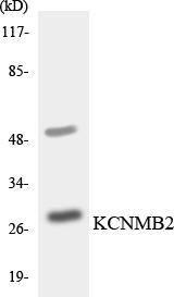 Western blot analysis of the lysates from HepG2 cells using Anti-KCNMB2 Antibody