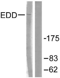 Western blot analysis of lysates from A549 cells using Anti-EDD Antibody. The right hand lane represents a negative control, where the antibody is blocked by the immunising peptide.