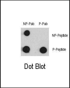 Anti-MEF2C Rabbit Polyclonal Antibody (AP (Alkaline Phosphatase))