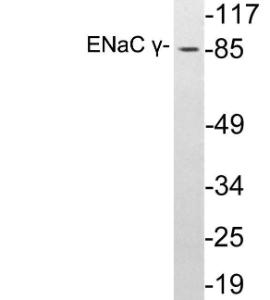 Western blot analysis of lysates from A549 cells using Anti-ENaC gamma Antibody