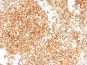 Immunohistochemical analysis of formalin-fixed, paraffin-embedded human tonsil using Anti-CD45 Antibody [PTPRC/1147 + PTPRC/1460]