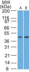 Anti-SSTR1 Rabbit Polyclonal Antibody