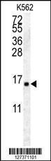 Anti-HIST2H2AA4 Rabbit Polyclonal Antibody