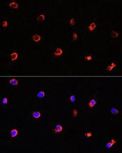 Immunofluorescence analysis of Y79 cells using Anti-AIPL1 Antibody (A9876) at a dilution of 1:100. DAPI was used to stain the cell nuclei (blue)