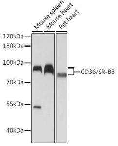 Western blot analysis of extracts of various cell lines, using Anti-CD36 Antibody (A309254) at 1:1,000 dilution