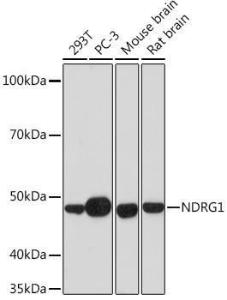 Western blot analysis of extracts of various cell lines, using Anti-NDRG1 Antibody [ARC0887] (A306340) at 1:1,000 dilution