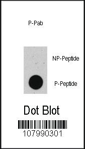 Anti-TP53 Rabbit Polyclonal Antibody