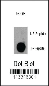 Anti-PIK3CD Rabbit Polyclonal Antibody