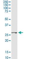 Anti-CCNB1IP1 Rabbit Polyclonal Antibody