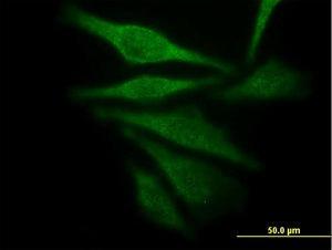 Anti-AKR1C4 Mouse Monoclonal Antibody [clone: 2C11]