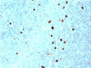 Immunohistochemical analysis of formalin-fixed, paraffin-embedded human tonsil using Anti-Human IgM Heavy Chain Antibody [SPM557]