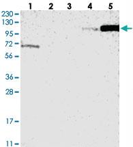 Anti-ANKRD44 Rabbit Polyclonal Antibody