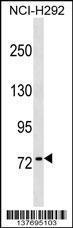 Anti-KHNYN Rabbit Polyclonal Antibody (AP (Alkaline Phosphatase))