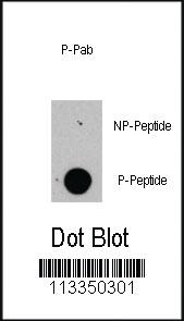 Anti-RPTOR Rabbit Polyclonal Antibody