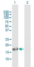 Anti-GRIN2C Mouse Polyclonal Antibody