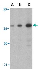 Anti-SOCS1 Rabbit Polyclonal Antibody